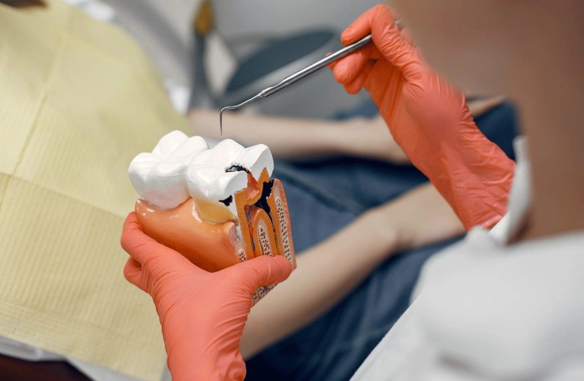 Kanal Tedavisi (Endodonti)